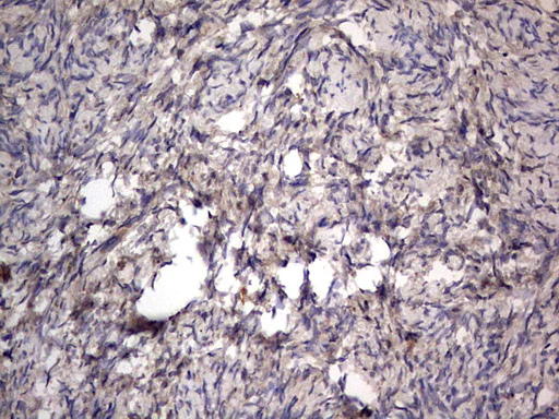 Immunohistochemistry (Formalin/PFA-fixed paraffin-embedded sections) - Anti-Acid sphingomyelinase antibody [OTI3H7] - BSA and Azide free (AB273656)
