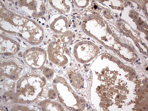 Immunohistochemistry (Formalin/PFA-fixed paraffin-embedded sections) - Anti-Acid sphingomyelinase antibody [OTI3H7] - BSA and Azide free (ab273656), expandable thumbnail