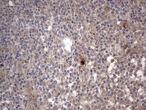 Immunohistochemistry (Formalin/PFA-fixed paraffin-embedded sections) - Anti-Acid sphingomyelinase antibody [OTI3H7] - BSA and Azide free (AB273656), expandable thumbnail