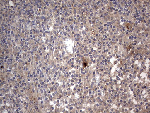 Immunohistochemistry (Formalin/PFA-fixed paraffin-embedded sections) - Anti-Acid sphingomyelinase antibody [OTI3H7] - BSA and Azide free (AB273656)