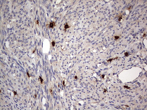 Immunohistochemistry (Formalin/PFA-fixed paraffin-embedded sections) - Anti-Acid sphingomyelinase antibody [OTI3H7] - BSA and Azide free (ab273656), expandable thumbnail