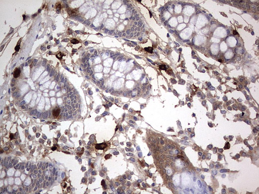 Immunohistochemistry (Formalin/PFA-fixed paraffin-embedded sections) - Anti-Acid sphingomyelinase antibody [OTI3H7] - BSA and Azide free (ab273656), expandable thumbnail
