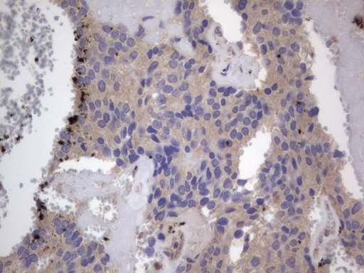 Immunohistochemistry (Formalin/PFA-fixed paraffin-embedded sections) - Anti-Acid sphingomyelinase antibody [OTI3H7] - BSA and Azide free (ab273656), expandable thumbnail