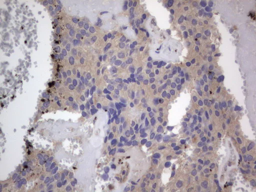 Immunohistochemistry (Formalin/PFA-fixed paraffin-embedded sections) - Anti-Acid sphingomyelinase antibody [OTI3H7] - BSA and Azide free (AB273656)