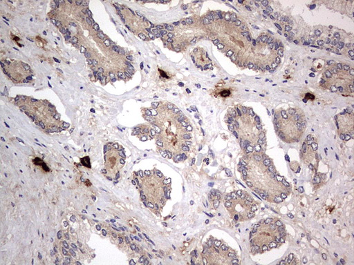 Immunohistochemistry (Formalin/PFA-fixed paraffin-embedded sections) - Anti-Acid sphingomyelinase antibody [OTI3H7] - BSA and Azide free (AB273656), expandable thumbnail