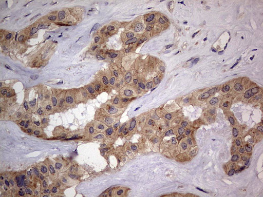 Immunohistochemistry (Formalin/PFA-fixed paraffin-embedded sections) - Anti-Acid sphingomyelinase antibody [OTI3H7] - BSA and Azide free (ab273656), expandable thumbnail