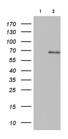Western blot - Anti-Acid sphingomyelinase antibody [OTI3H7] - BSA and Azide free (AB273656), expandable thumbnail