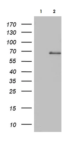 Western blot - Anti-Acid sphingomyelinase antibody [OTI3H7] - BSA and Azide free (AB273656)