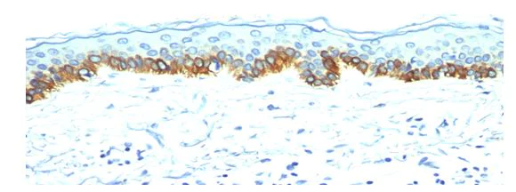 Immunohistochemistry (Formalin/PFA-fixed paraffin-embedded sections) - Anti-Acidic Cytokeratin antibody [AE-1] (AB187381)