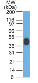 Western blot - Anti-Acidic Cytokeratin antibody [AE-1] (AB187381)