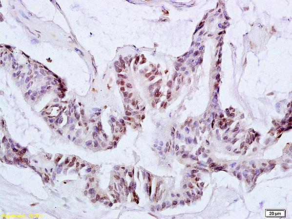 Immunohistochemistry (Formalin/PFA-fixed paraffin-embedded sections) - Anti-ACK1 antibody (AB216955), expandable thumbnail