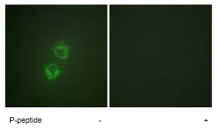 Immunocytochemistry/ Immunofluorescence - Anti-ACK1 (phospho Y284) antibody (AB74091)