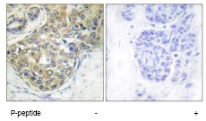 Immunohistochemistry (Formalin/PFA-fixed paraffin-embedded sections) - Anti-ACK1 (phospho Y284) antibody (AB74091)