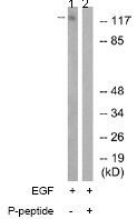 Western blot - Anti-ACK1 (phospho Y284) antibody (AB74091)