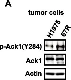 Western blot - Anti-ACK1 (phospho Y284) antibody (AB74091)