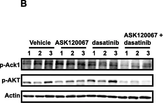 Western blot - Anti-ACK1 (phospho Y284) antibody (AB74091)