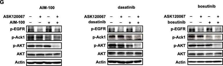 Western blot - Anti-ACK1 (phospho Y284) antibody (AB74091)