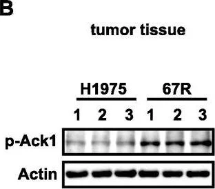 Western blot - Anti-ACK1 (phospho Y284) antibody (AB74091)