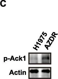 Western blot - Anti-ACK1 (phospho Y284) antibody (AB74091)
