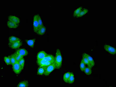 Immunocytochemistry/ Immunofluorescence - Anti-ACMSD antibody (AB237522)