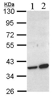 Western blot - Anti-ACMSD antibody (AB96081)