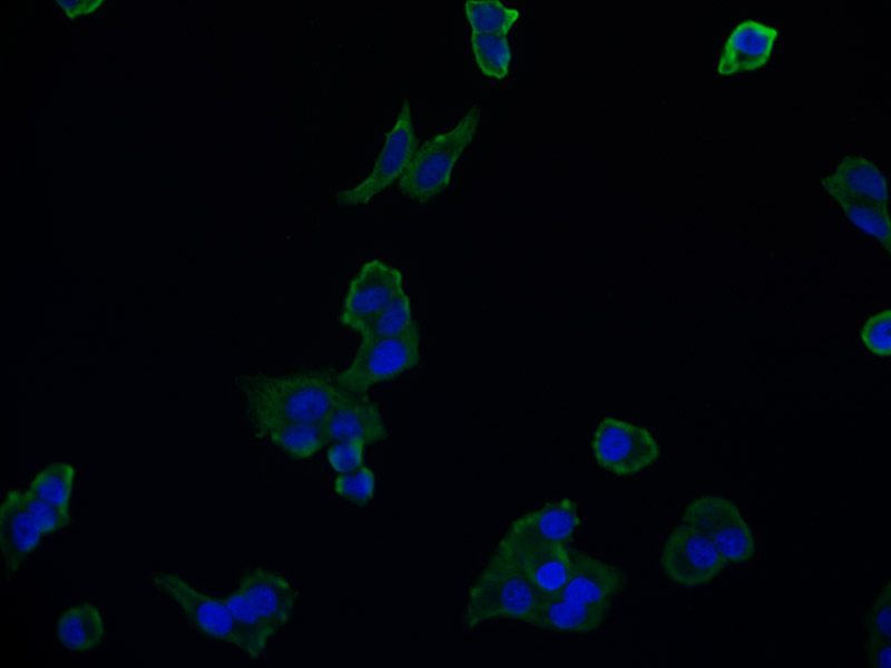 Immunocytochemistry/ Immunofluorescence - Anti-Aconitase 1/ACO1 antibody [22C10] (AB314179), expandable thumbnail
