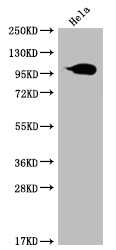 Western blot - Anti-Aconitase 1/ACO1 antibody [22C10] (AB314179), expandable thumbnail