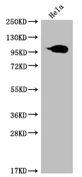 Western blot - Anti-Aconitase 1/ACO1 antibody [22C10] (AB314179)