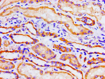 Immunohistochemistry (Formalin/PFA-fixed paraffin-embedded sections) - Anti-Aconitase 1/ACO1 antibody (AB236773)