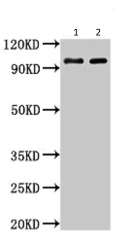 Western blot - Anti-Aconitase 1/ACO1 antibody (AB236773)