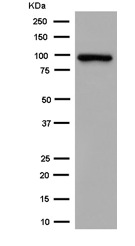 Western blot - Anti-Aconitase 1/ACO1 antibody [EPR7226(2)] - BSA and Azide free (AB250695), expandable thumbnail