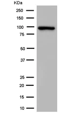 Western blot - Anti-Aconitase 1/ACO1 antibody [EPR7226(2)] - BSA and Azide free (AB250695)