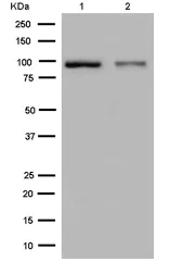 Western blot - Anti-Aconitase 1/ACO1 antibody [EPR7226(2)] - BSA and Azide free (AB250695)