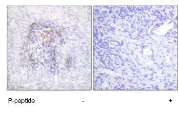 Immunohistochemistry (Formalin/PFA-fixed paraffin-embedded sections) - Anti-Aconitase 1/ACO1 (phospho S138) antibody (AB63260)