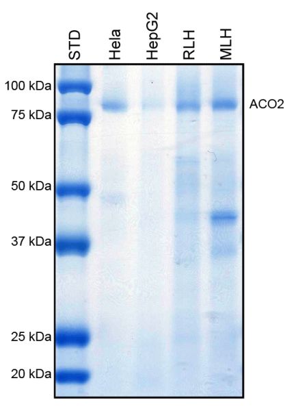 Immunoprecipitation - Anti-Aconitase 2 antibody [6D1BE4] (AB110320), expandable thumbnail