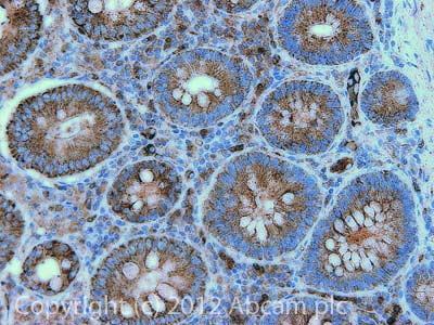 Immunohistochemistry (Formalin/PFA-fixed paraffin-embedded sections) - Anti-Aconitase 2 antibody [6F12BD9] (AB110321), expandable thumbnail
