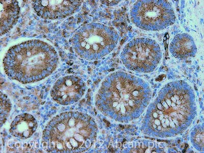 Immunohistochemistry (Formalin/PFA-fixed paraffin-embedded sections) - Anti-Aconitase 2 antibody [6F12BD9] (AB110321)