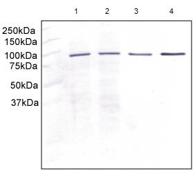 Western blot - Anti-Aconitase 2 antibody [6F12BD9] (AB110321), expandable thumbnail