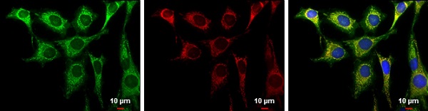 Immunocytochemistry/ Immunofluorescence - Anti-Aconitase 2 antibody (ab228923), expandable thumbnail