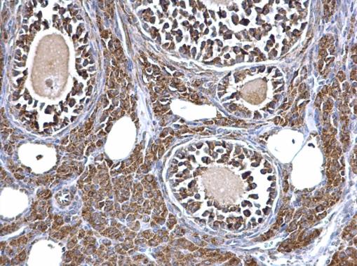 Immunohistochemistry (Formalin/PFA-fixed paraffin-embedded sections) - Anti-Aconitase 2 antibody (ab228923), expandable thumbnail