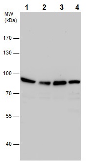 Western blot - Anti-Aconitase 2 antibody (AB228923), expandable thumbnail