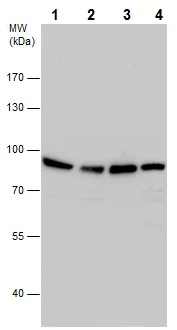 Western blot - Anti-Aconitase 2 antibody (AB228923)