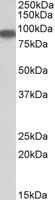 Western blot - Anti-Aconitase 2 antibody (AB99467), expandable thumbnail