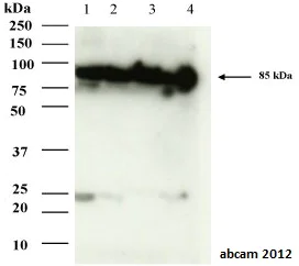 Western blot - Anti-Aconitase 2 antibody [EPR8283(B)] (AB129105)