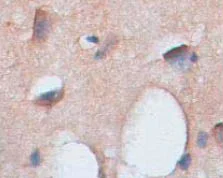 Immunohistochemistry (Formalin/PFA-fixed paraffin-embedded sections) - Anti-ACOT7 antibody (AB85151)