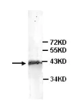 Western blot - Anti-ACOT7 antibody (AB85151)