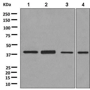 Western blot - Anti-ACOT7 antibody [EPR11317(B)] (AB156576)