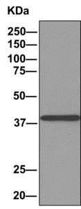 Immunoprecipitation - Anti-ACOT7 antibody [EPR11317(B)] - BSA and Azide free (AB249270)