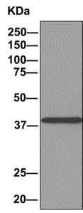 Immunoprecipitation - Anti-ACOT7 antibody [EPR11317(B)] - BSA and Azide free (AB249270)