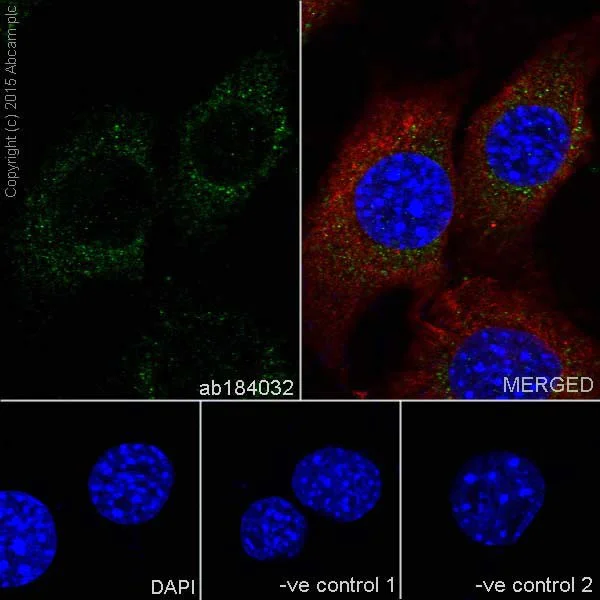 Anti-ACOX1/AOX antibody [EPR19038] (ab184032) | Abcam